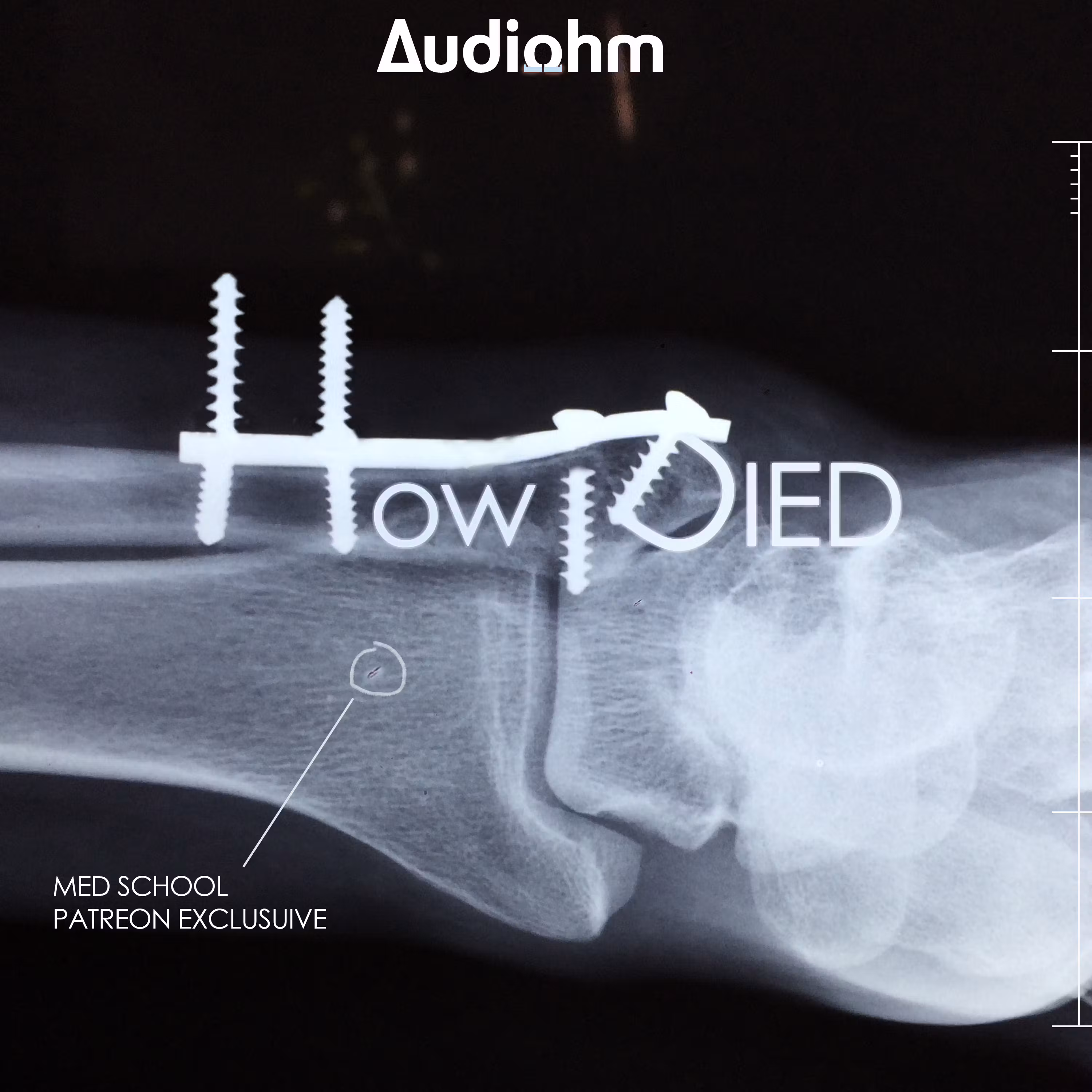 How i Died: Med School Prequel Series -- OUT NOW! cover art